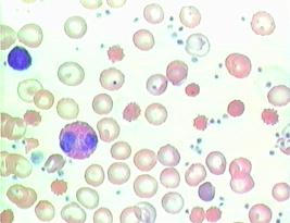 blood smear essay blood smear essay